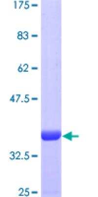 SDS-PAGE: Recombinant Human ACYP2 GST (N-Term) Protein [H00000098-P01]