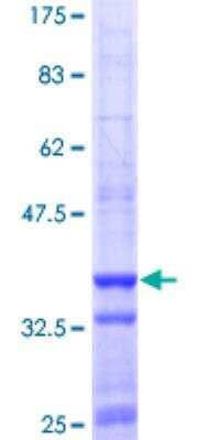 SDS-PAGE: Recombinant Human ADAR GST (N-Term) Protein [H00000103-Q01]