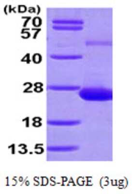 SDS-PAGE: Recombinant Human ADAT2 His Protein [NBP1-48387]