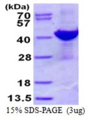 SDS-PAGE: Recombinant Human ADP-ribosylarginine hydrolase His Protein [NBP1-98899]