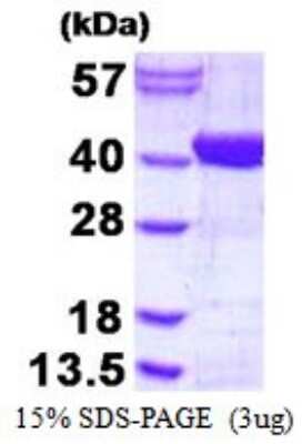 SDS-PAGE: Recombinant Human ADPRHL2 His Protein [NBP1-98877]