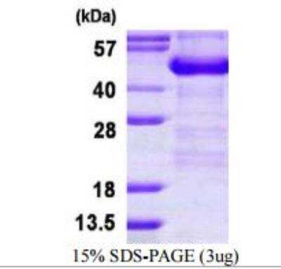 SDS-PAGE: Recombinant Human ADRM1 His Protein [NBP1-99027]