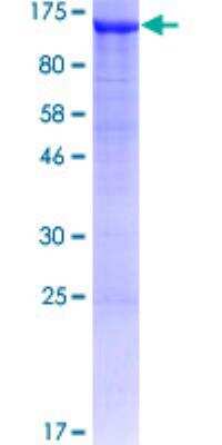 SDS-PAGE: Recombinant Human ADTB1 GST (N-Term) Protein [H00000162-P01]