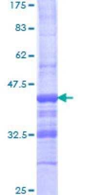 SDS-PAGE: Recombinant Human AE Binding Protein 1/ACLP GST (N-Term) Protein [H00000165-Q01]