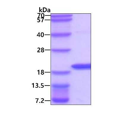 SDS-PAGE: Recombinant Human AG-3/AGR3 His Protein [NBP1-72342]