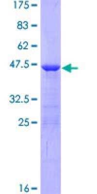 SDS-PAGE: Recombinant Human AHNAK GST (N-Term) Protein [H00079026-P01]