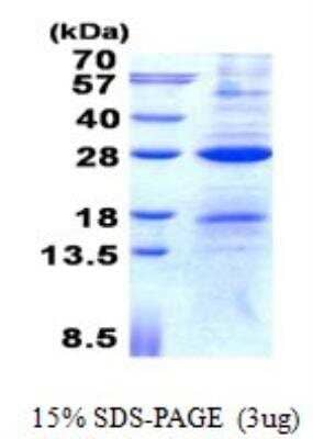 SDS-PAGE: Recombinant Human AICDA His Protein [NBP2-22671]