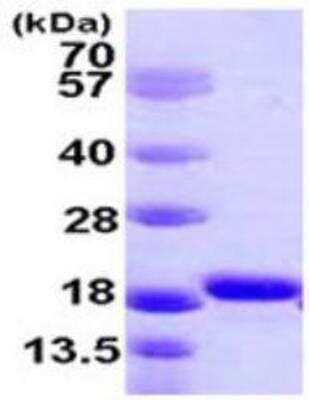 SDS-PAGE: Recombinant Human AIF-1/Iba1 His Protein [NBP1-51074]