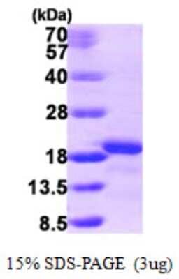 SDS-PAGE: Recombinant Human AIF1L His Protein [NBP1-50962]