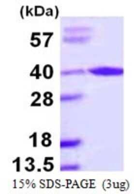 SDS-PAGE: Recombinant Human AIP/ARA9 His Protein [NBP1-72382]