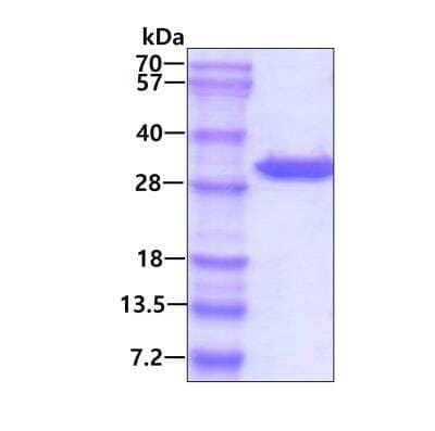 SDS-PAGE: Recombinant Human AK2 His Protein [NBC1-18530]