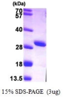 SDS-PAGE: Recombinant Human AK3L1 His Protein [NBP1-72279]