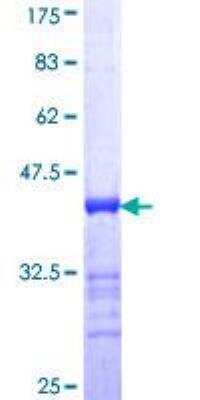 SDS-PAGE: Recombinant Human AKAP4 GST (N-Term) Protein [H00008852-Q01]