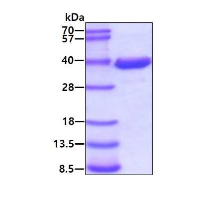 SDS-PAGE: Recombinant Human AKR1B1 Protein [NBC1-22925]