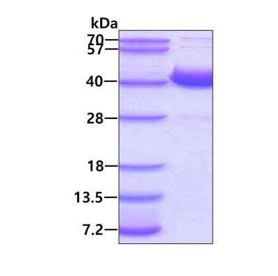 SDS-PAGE: Recombinant Human AKR1D1 His Protein [NBP1-51026]