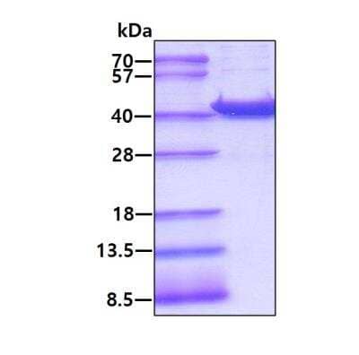 SDS-PAGE: Recombinant Human AKR7A3 His Protein [NBP1-40394]