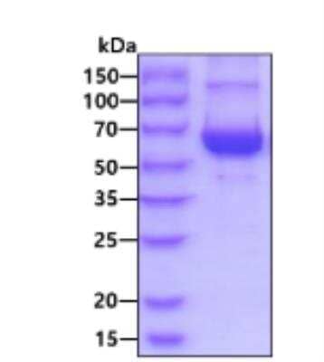 SDS-PAGE: Recombinant Human AKT1 His Protein [NBP2-52121]