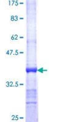 SDS-PAGE: Recombinant Human ALAS2 GST (N-Term) Protein [H00000212-Q01]