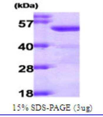 SDS-PAGE: Recombinant Human ALDH2 Protein [NBC1-19053]