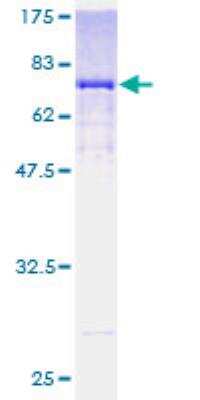 SDS-PAGE: Recombinant Human ALDH3B1 GST (N-Term) Protein [H00000221-P01]