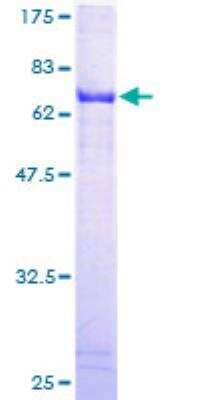 SDS-PAGE: Recombinant Human ALDH3B2 GST (N-Term) Protein [H00000222-P01]