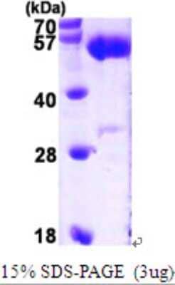 SDS-PAGE: Recombinant Human ALDH5A1 His Protein [NBP1-48596]