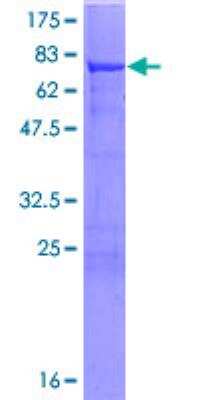 SDS-PAGE: Recombinant Human ALDH7A1 GST (N-Term) Protein [H00000501-P01]