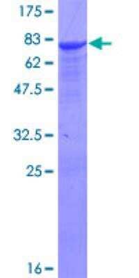 SDS-PAGE: Recombinant Human ALDH9A1 GST (N-Term) Protein [H00000223-P01]