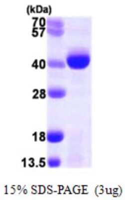 SDS-PAGE: Recombinant Human ALKBH3 His Protein [NBP1-51051]