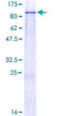 SDS-PAGE: Recombinant Human ALOX12B GST (N-Term) Protein [H00000242-P01]