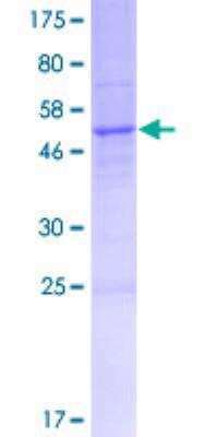 SDS-PAGE: Recombinant Human ALOX12P2 GST (N-Term) Protein [H00000245-P01]