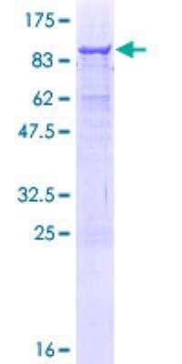 SDS-PAGE: Recombinant Human Ameloblastin GST (N-Term) Protein [H00000258-P01]