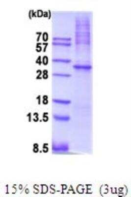 SDS-PAGE: Recombinant Human AMPK alpha 1 His Protein [NBP2-51992]