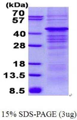 SDS-PAGE: Recombinant Human AMPK beta 1 His Protein [NBP2-23375]