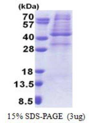 SDS-PAGE: Recombinant Human AMPK gamma 1 His Protein [NBP2-23377]