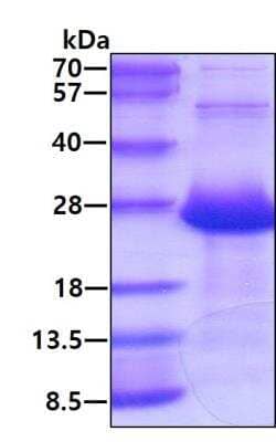 SDS-PAGE: Recombinant Human AMTN His Protein [NBP2-22684]