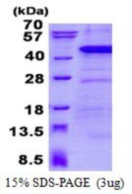 SDS-PAGE: Recombinant Human ANKRD1 His Protein [NBP2-22687]