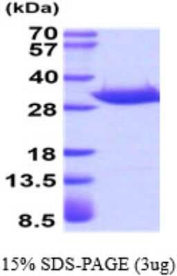 SDS-PAGE: Recombinant Human ANP32A His Protein [NBP1-48390]