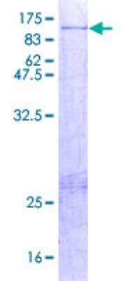 SDS-PAGE: Recombinant Human AOC2 GST (N-Term) Protein [H00000314-P01]