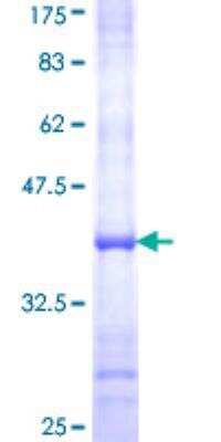 SDS-PAGE: Recombinant Human AOC2 GST (N-Term) Protein [H00000314-Q01]