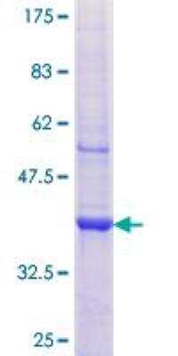 SDS-PAGE: Recombinant Human AP1M2 GST (N-Term) Protein [H00010053-Q01]