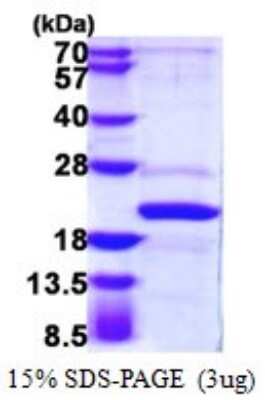 SDS-PAGE: Recombinant Human AP1S2 His Protein [NBP1-72332]