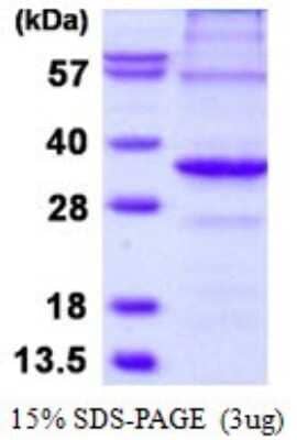 SDS-PAGE: Recombinant Human APIP His Protein [NBP1-98917]