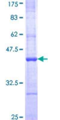 SDS-PAGE: Recombinant Human APOBEC1 GST (N-Term) Protein [H00000339-Q01]