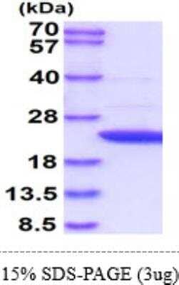 SDS-PAGE: Recombinant Human APRT Protein [NBP1-40402]