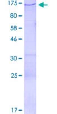 SDS-PAGE: Recombinant Human ARAP1 GST (N-Term) Protein [H00116985-P01]