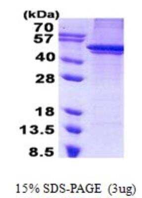 SDS-PAGE: Recombinant Human ARC/ARG3.1 His Protein [NBP2-22672]