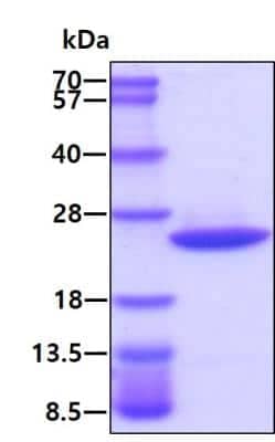 SDS-PAGE: Recombinant Human ARF1 His Protein [NBP1-45297]