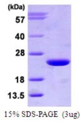 SDS-PAGE: Recombinant Human ARF3 His Protein [NBP1-72457]