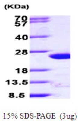 SDS-PAGE: Recombinant Human ARF4 His Protein [NBP1-50948]